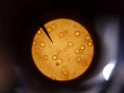 Goldalge  Chrysophyceen